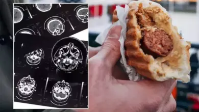 Kebiasaan Makan Daging Olahan Berisiko Picu Demensia Lebih Cepat, Penelitian Ungkap