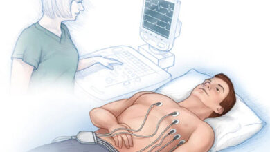 Kenali 4 Tes Medis untuk Memantau Kesehatan Arteri Jantung Anda