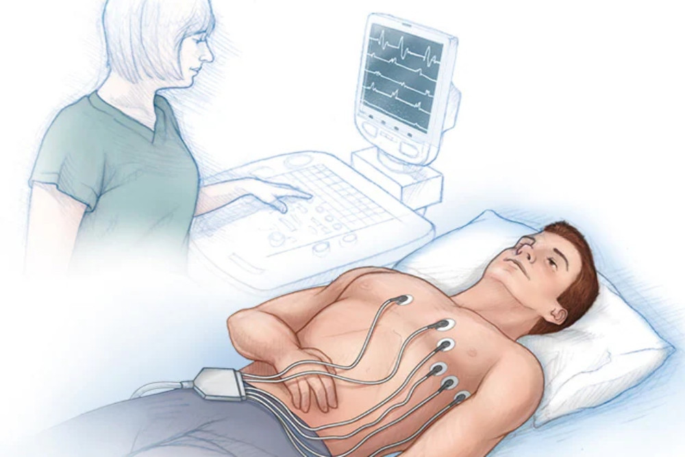 Kenali 4 Tes Medis untuk Memantau Kesehatan Arteri Jantung Anda