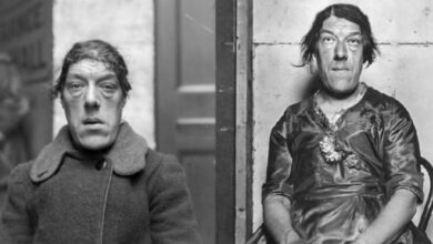 Kisah Pilu Mary Ann Bevan: Perjuangan Wanita Terjelek Menantang Takdir