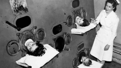 Ngeri! 10 Alat Medis Jadul yang Bikin Kita Bersyukur di Zaman Sekarang