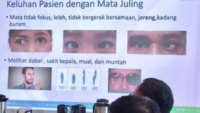 Anak Kelamaan Main HP Bisa Bikin Mata Juling: Ini Faktanya yang Perlu Diketahui
