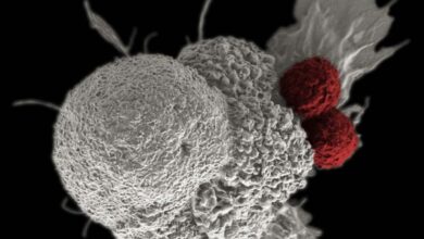 AstraZeneca Luncurkan Terapi Inovatif untuk Sembuhkan Kanker Payudara