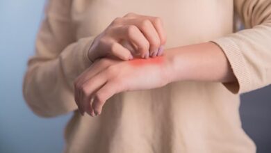 Cuaca Panas Picu Kulit Gatal dan Ruam Merah? Kenali Alergi dan Obat Tepat!