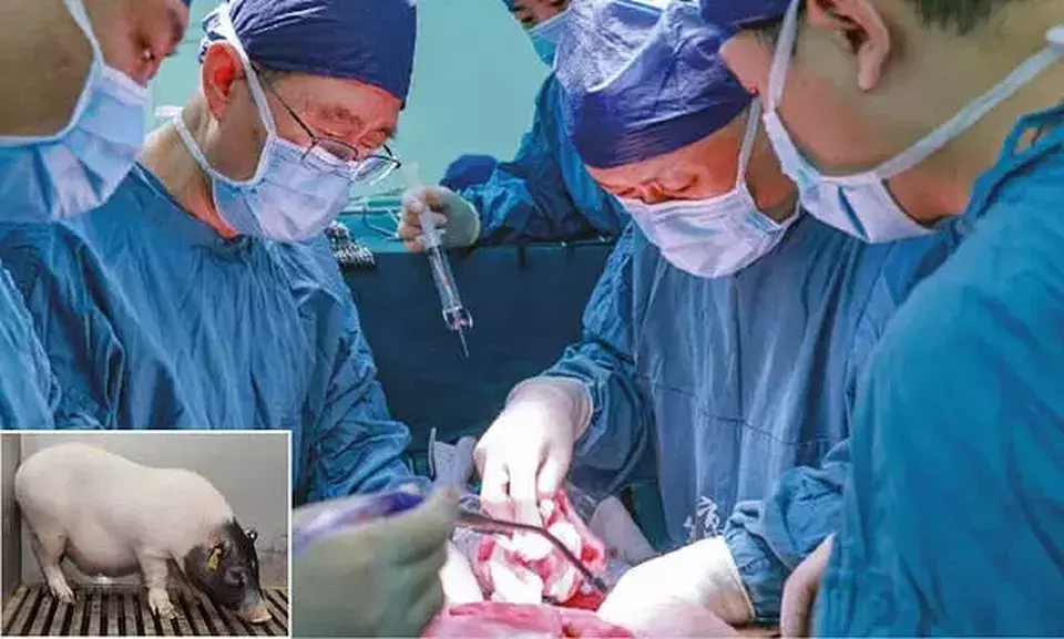 Hati Babi Berhasil Ditanam ke Tubuh Manusia: Sejarah Baru Medis Terlahir