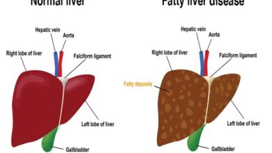 Ini 15 Makanan Alami yang Efektif untuk Detoks Liver Anda