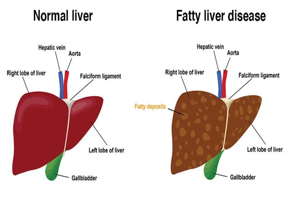 Ini 15 Makanan Alami yang Efektif untuk Detoks Liver Anda