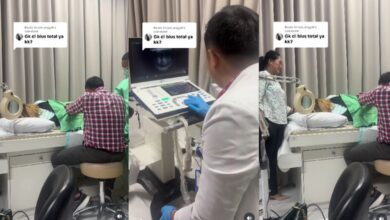 Lina Mukherjee Jalani Operasi Tanpa Dibius Total, Apa Penyebabnya?