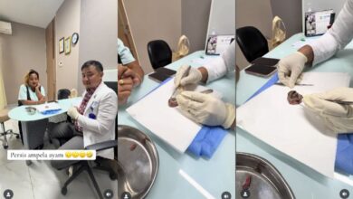 Mengenal Lipoma Mirip Ampla Ati pada Lina Mukherjee: Penyebab dan Gejalanya