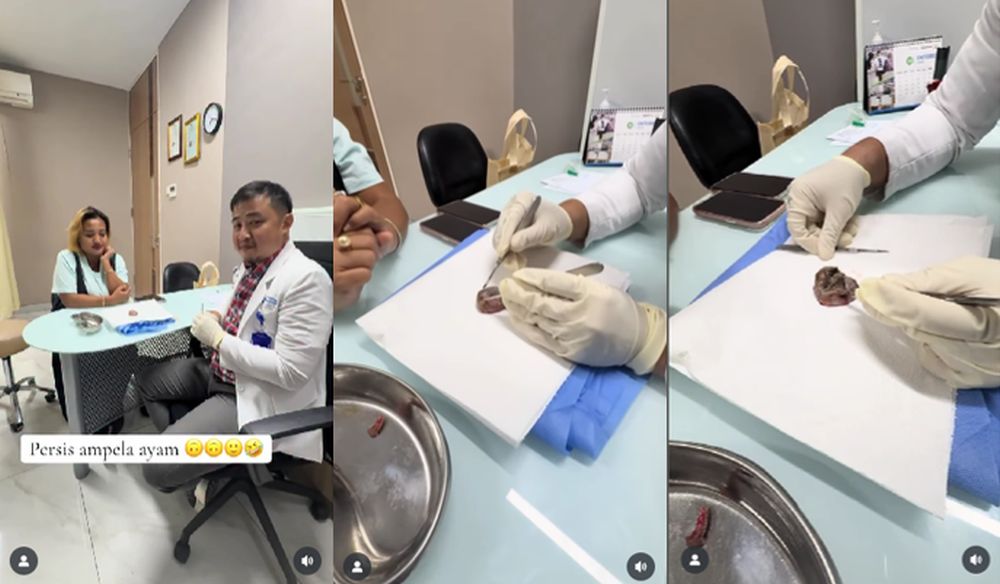 Mengenal Lipoma Mirip Ampla Ati pada Lina Mukherjee: Penyebab dan Gejalanya