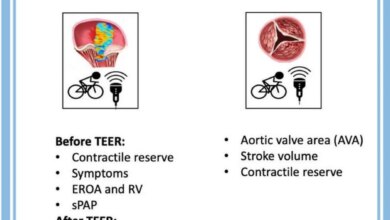 Mengenal TAVI dan TEER: Inovasi Bedah Jantung Minim Invasif Terbaru