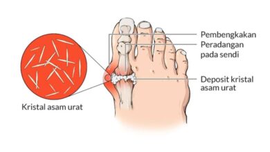 7 Kebiasaan Pagi yang Diuji Ahli untuk Kontrol Asam Urat Secara Alami