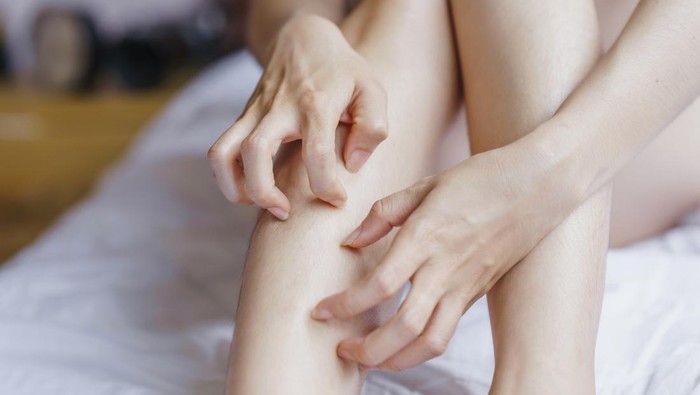 Gatal-gatal Tak Kunjung Hilang? Cek Bisa Jadi Tanda Awal Diabetes!