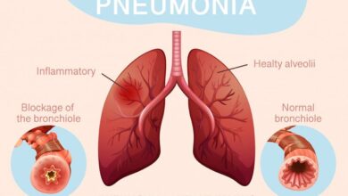 Hari Pneumonia Sedunia: Mengungkap Bahaya Penyakit Mematikan bagi Bayi di Seluruh Dunia