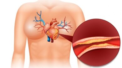 Penyakit Jantung Masih Jadi Pembunuh Utama: Inovasi Tanpa Operasi Besar yang Patut Diketahui