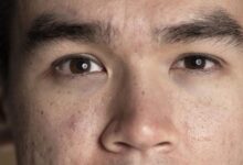 10 Rekomendasi Toner untuk Wajah Bruntusan, Harga di Bawah Rp120 Ribu dan Kualitas Terjamin