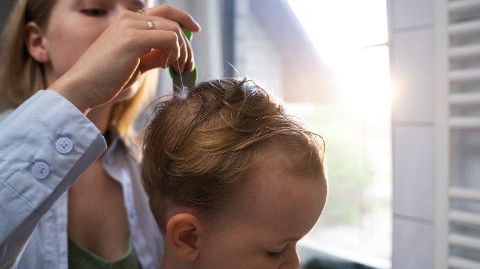 6 Rekomendasi Hair Lotion Bayi Terbaik untuk Rambut Lebat dan Sehat Sejak Dini
