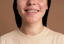 6 Rekomendasi Skincare Ampuh untuk Atasi Jerawat Batu, Simak Tips Perawatannya