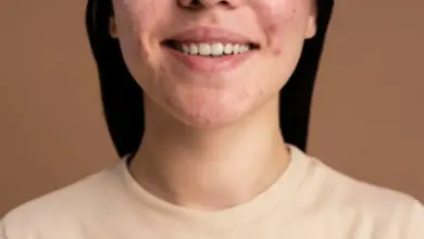 6 Rekomendasi Skincare Ampuh untuk Atasi Jerawat Batu, Simak Tips Perawatannya