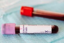 Golden Blood: Mengungkap Golongan Darah Super Langka yang Hanya Dimiliki Puluhan Orang!