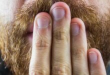 Mantan Presiden Jalani Operasi Mendadak Akibat Cegukan Tak Kunjung Sembuh, Apa Penyebabnya?