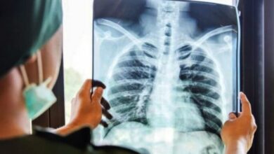 RS XYZ Datangkan Pakar Dunia Hadapi Tantangan Kompleks Bedah Bahu: Solusi Terbaru!