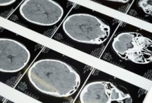 Studi Baru: Lima Tahap Perkembangan Kritis Otak Manusia yang Harus Anda Ketahui