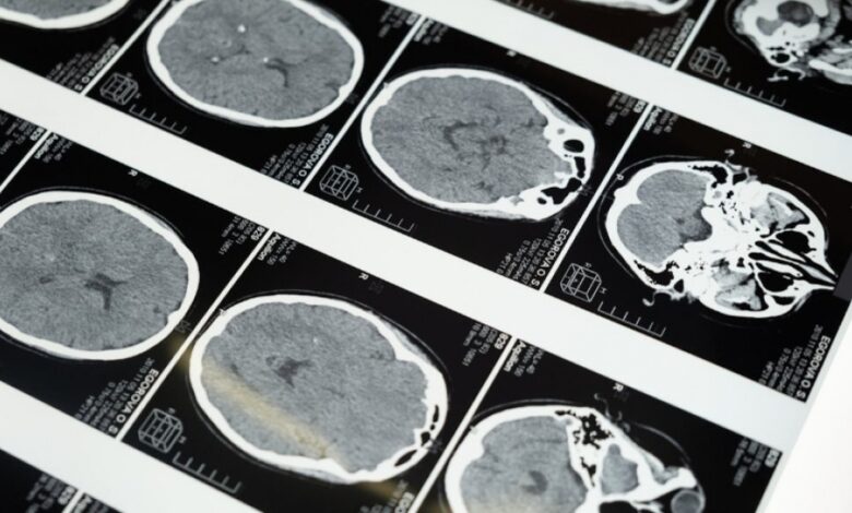 Studi Baru: Lima Tahap Perkembangan Kritis Otak Manusia yang Harus Anda Ketahui